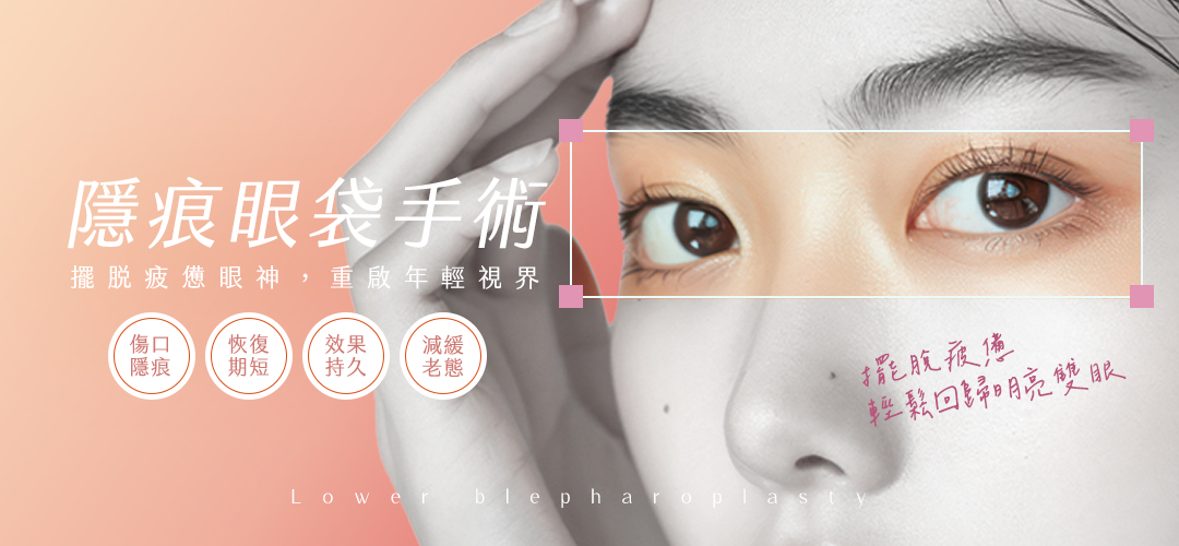 佳飛雅醫美｜隱痕眼袋手術 每天都精神飽滿！一次解決眼周困擾